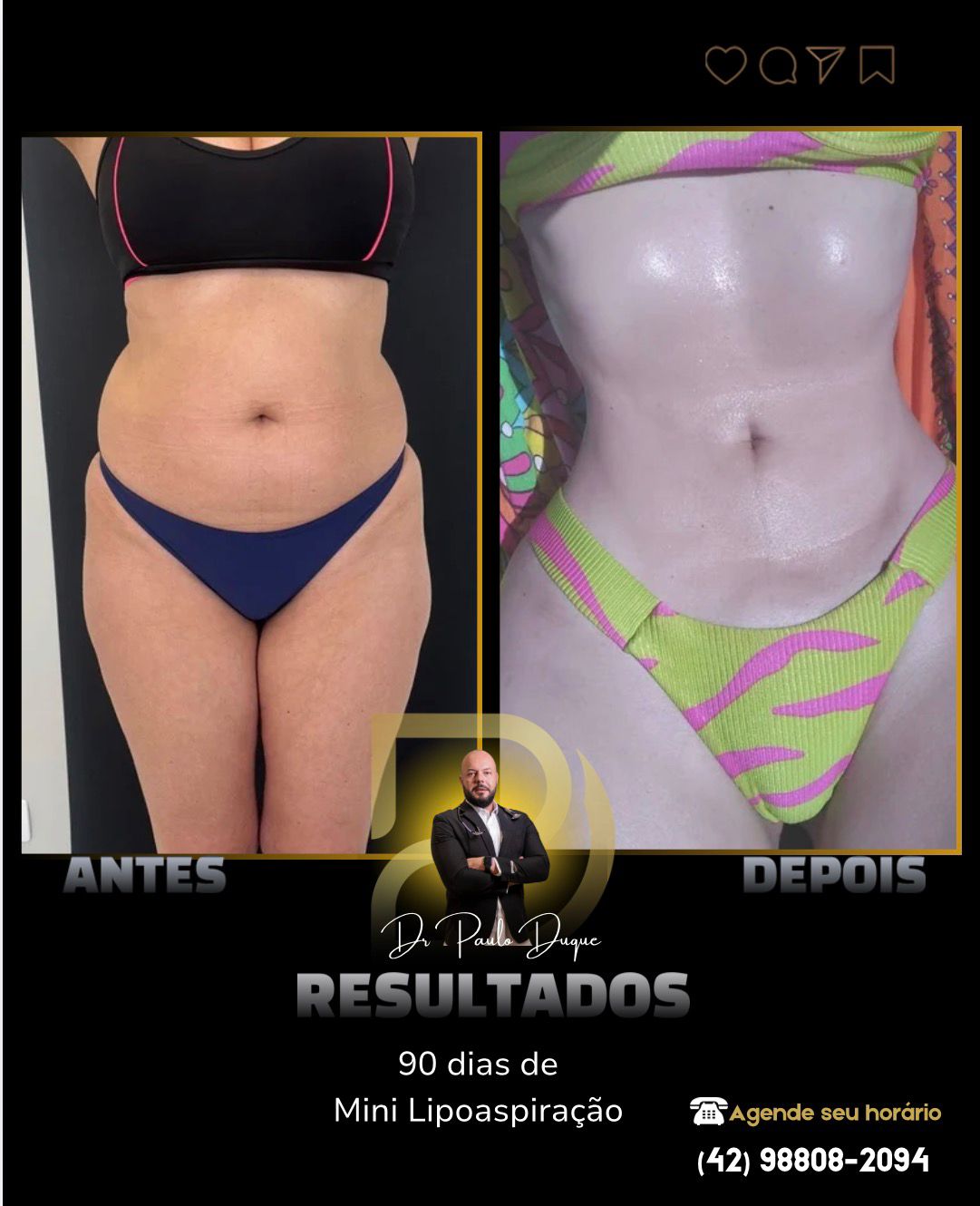 Resultado 01