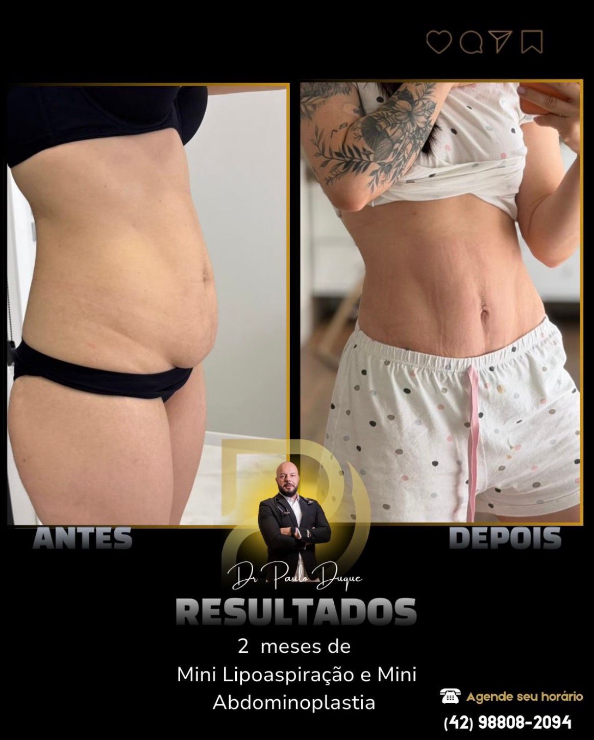 Resultado 03